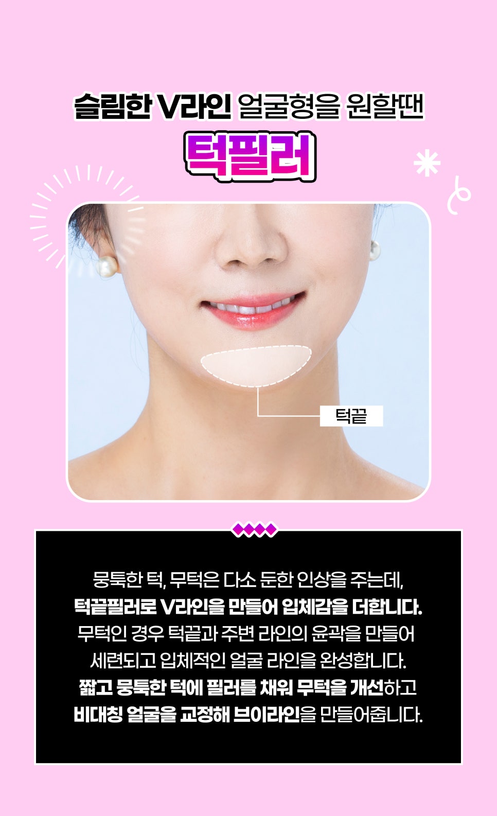동안필러로 볼륨감 만드는 방법 관련 이미지 5