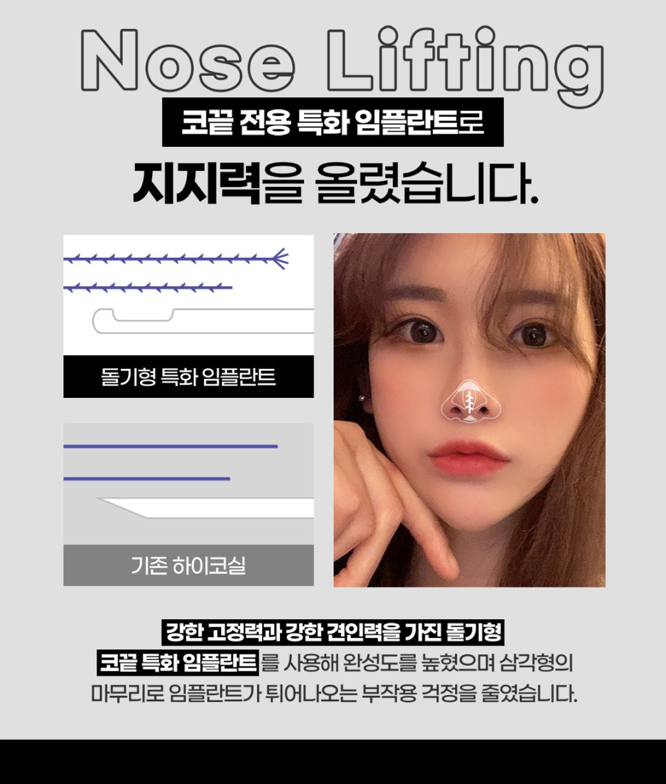 코끝시술, 제이필 코끝창조로 더 높게! 관련 이미지 4