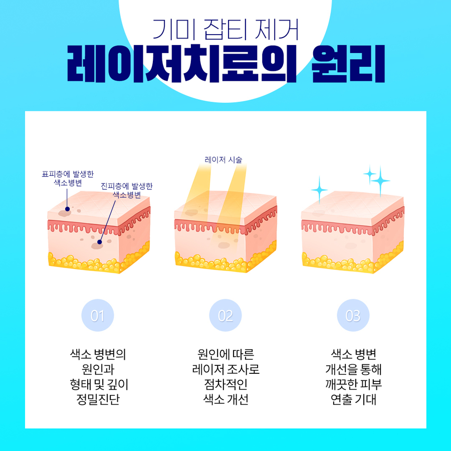 레이저시술로 모공,잡티,기미,피부톤개선이 가능할까요? 관련 이미지 5