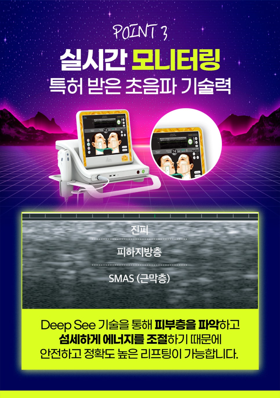 홍대리프팅, 슈링크와 울쎄라의 조합으로 관련 이미지 7