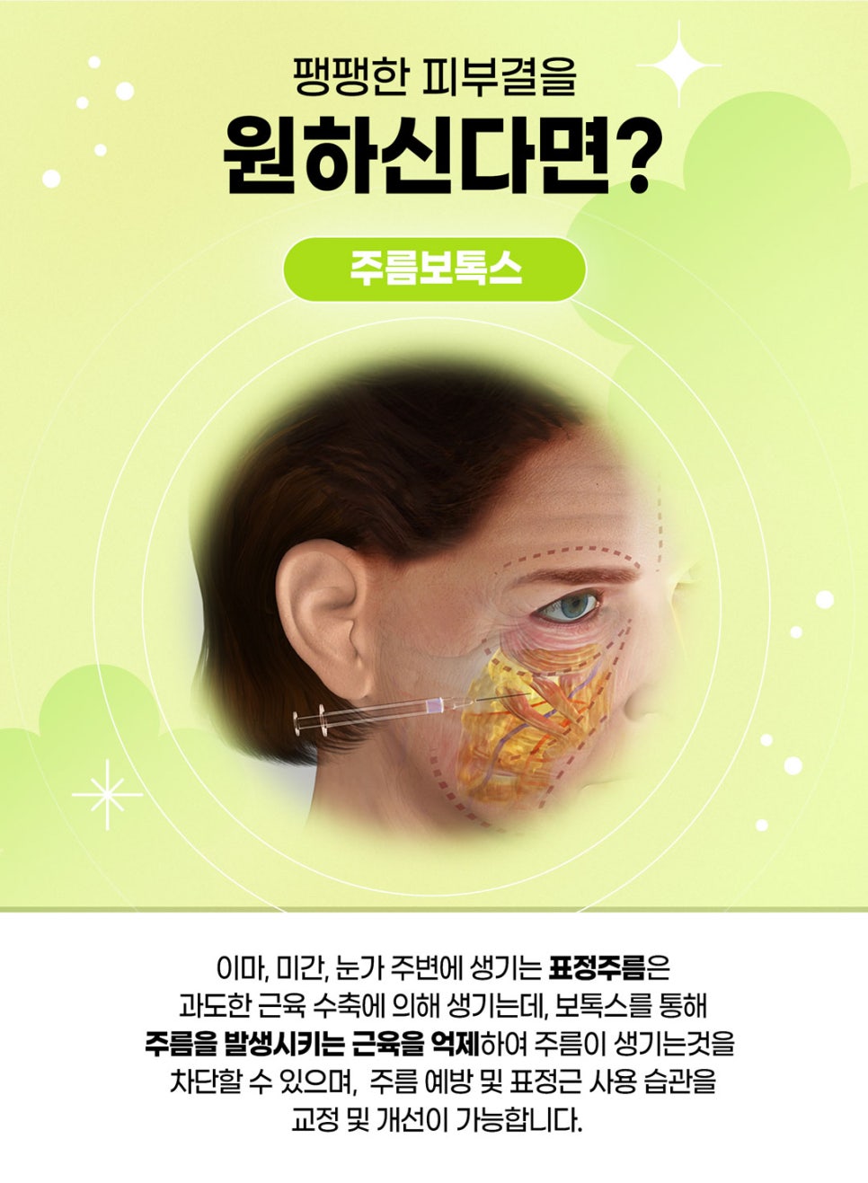 사각턱 주름보톡스로 갸름하고 팽팽하게! 관련 이미지 4