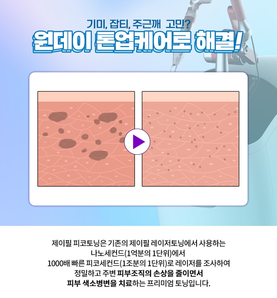 피코토닝과 라라필이 만나 색소침착피부를 밝고 환하게 관련 이미지 2