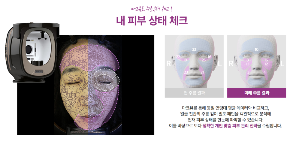 30대 40대 피부관리 추천|고우리·써마지·줄기세포 시술 TOP3 관련 이미지 11