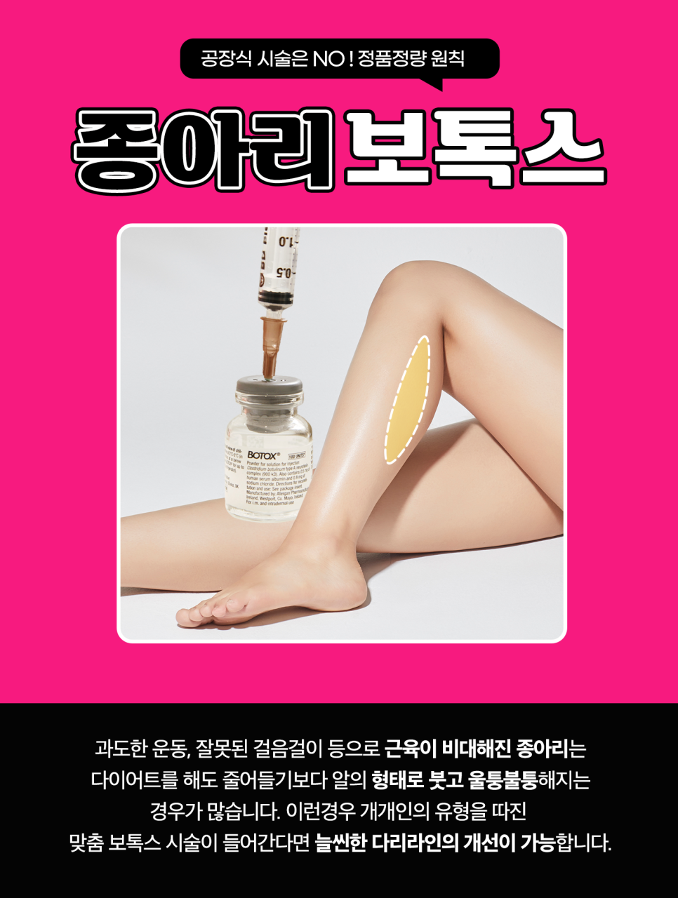 종아리근육빼기, 보톡스로 날씬한 다리 만들기 관련 이미지 3