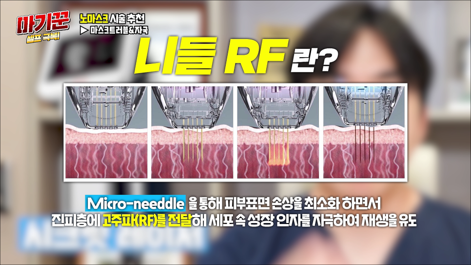 NO마스크 자신감을 올려봐요 마기꾼 셀프 극복! 관련 이미지 11
