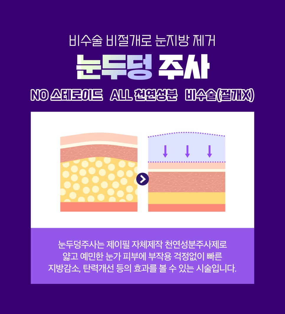 비절개 비수술로 눈두덩지방제거&눈매교정! 관련 이미지 2
