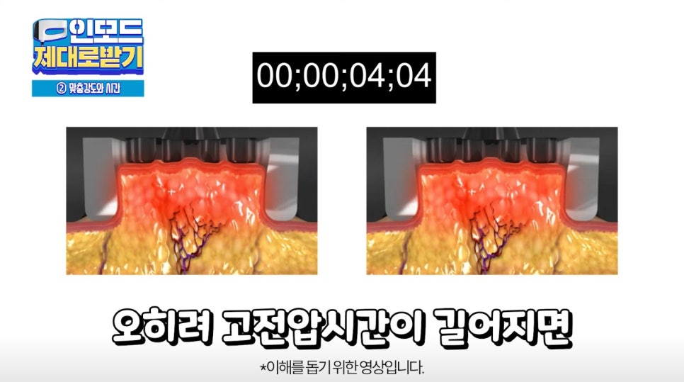 인모드효과 못 보셨다면 여기로 관련 이미지 21