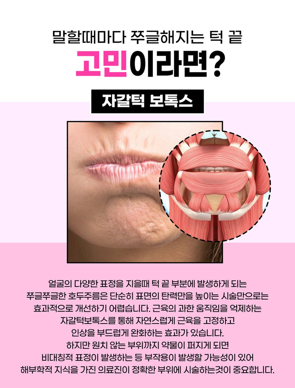 홍대역필러 턱끝필러로 윤곽살리기 관련 이미지 4