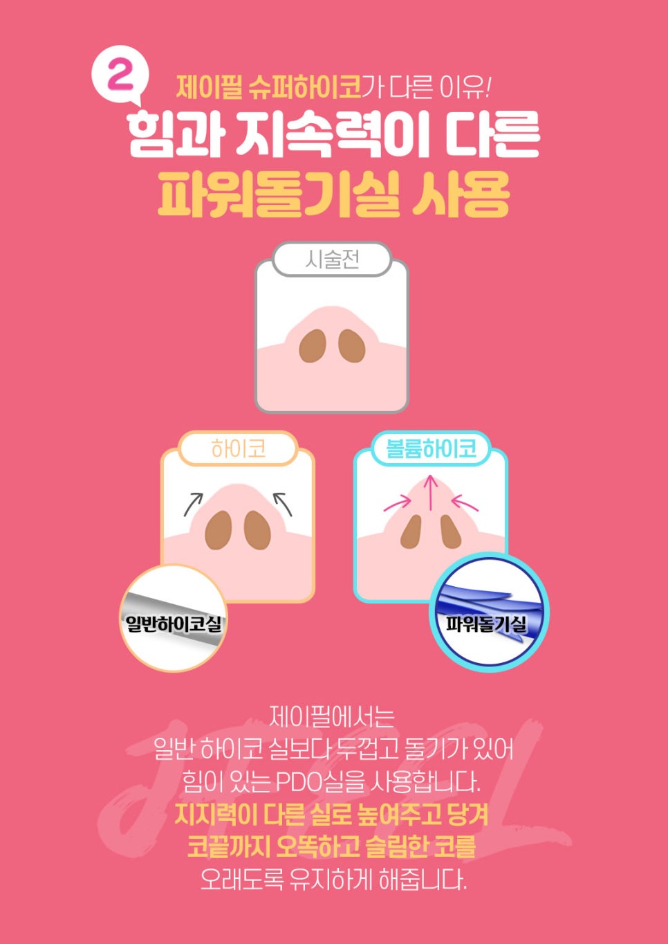 슈퍼하이코 만족도 높은 코 필러 알아본다면 제이필클리닉 관련 이미지 5