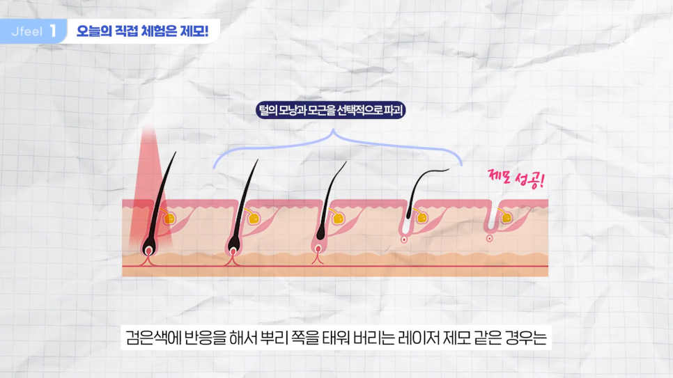 수염 레이저 제모 원장님 직접 리뷰 관련 이미지 2