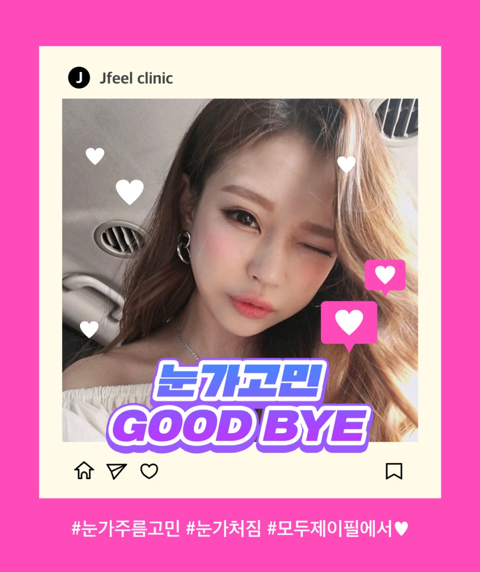 눈가 주름 개선에는 아이슈링크+눈가주름보톡스 관련 이미지 6