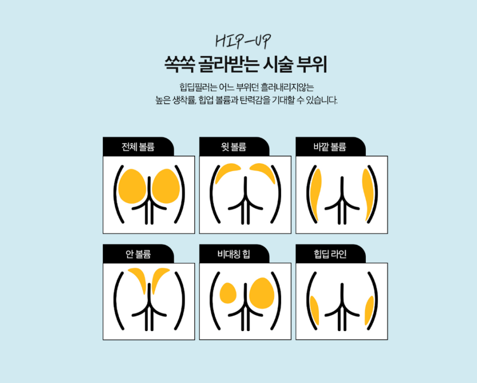 Why Butt-Only Workouts Aren't Enough｜When Hip Fillers Are Needed for Hip Dips image 22