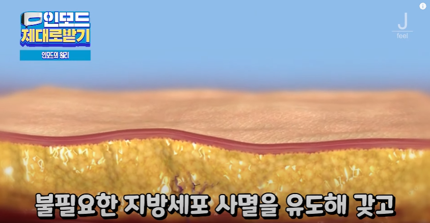 인모드효과 못 보셨다면 여기로 관련 이미지 9
