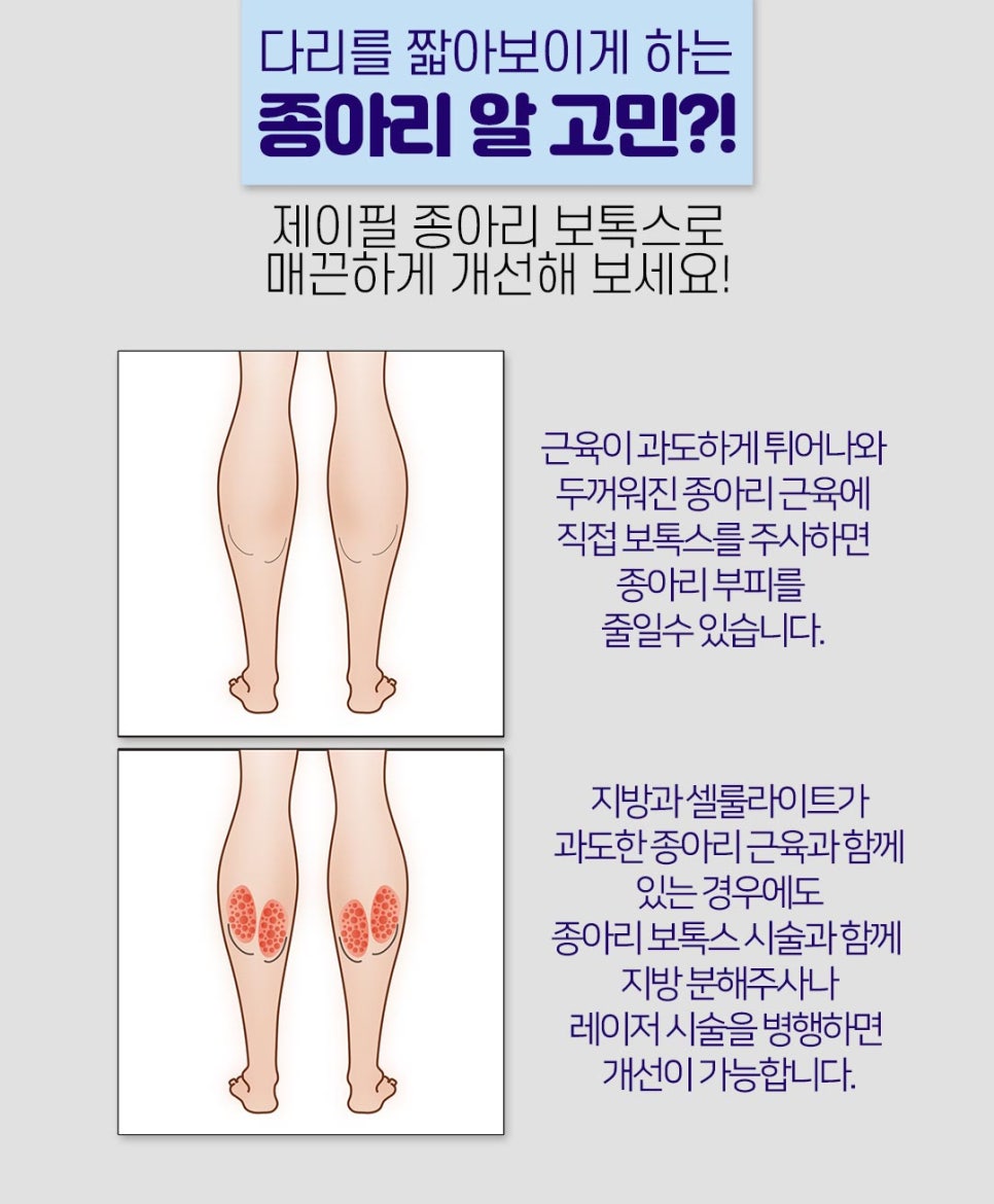 보톡스를 이용한 안면 주름개선과 발달된 근육 축소 시술 관련 이미지 12