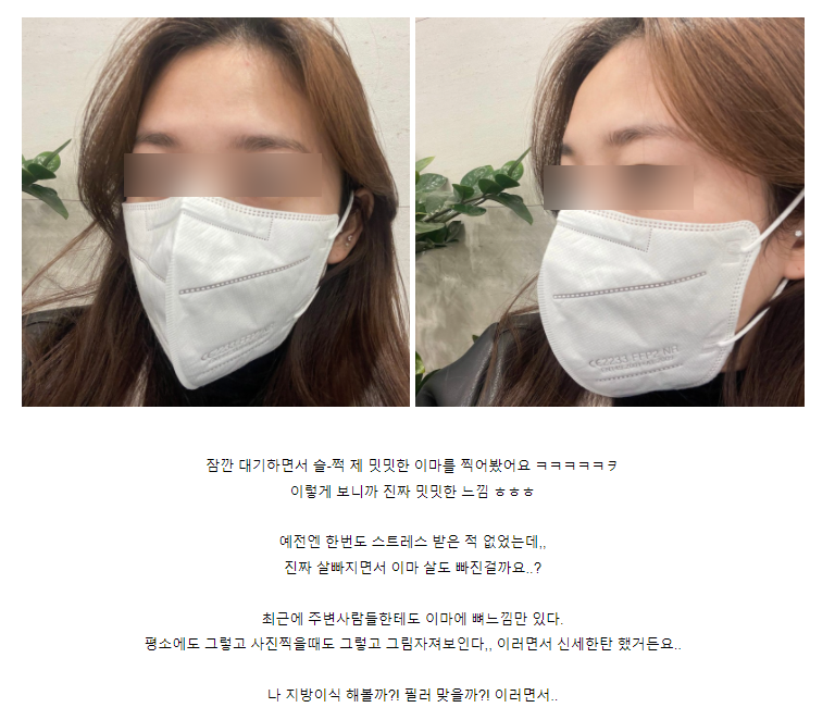 홍대 이마필러 잘하는 곳, 벨로테로 리얼 후기 관련 이미지 2