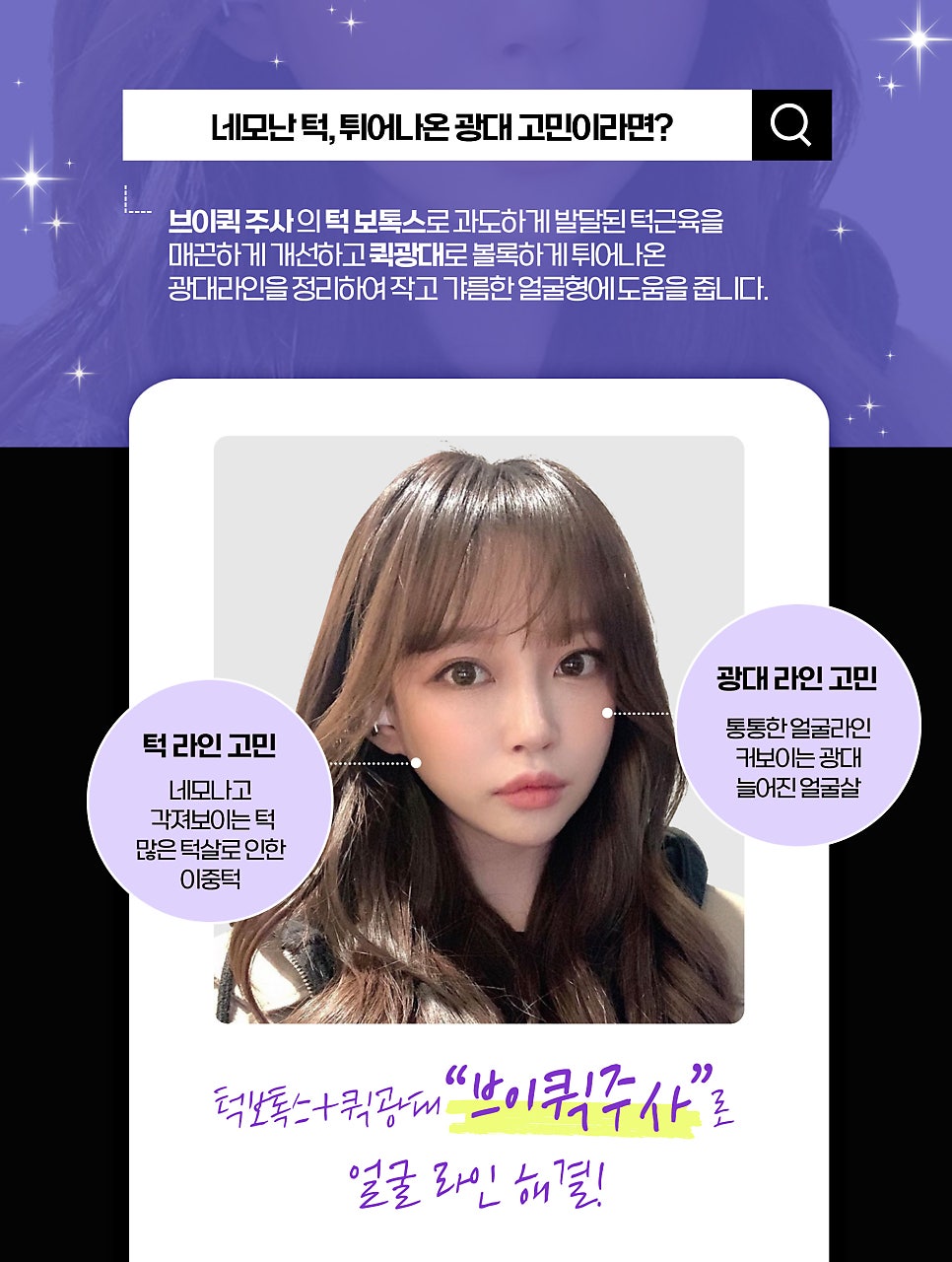 사각턱주사 얼굴 라인 개선을 원한다면 관련 이미지 2