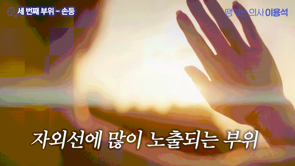 휴가 다녀왔더니 피부가 확 늙어 보인다? 여름철 피부관리 고우리 콜라겐부스터 관련 이미지 3