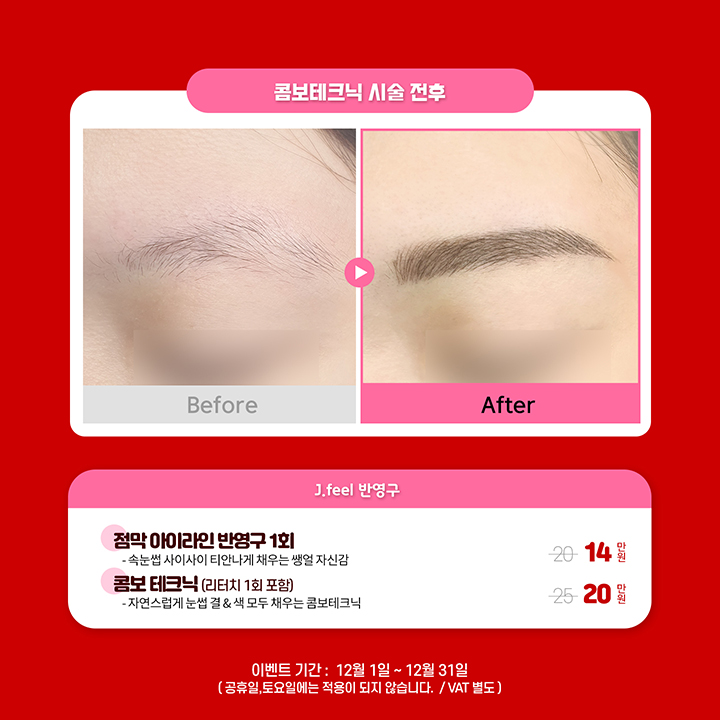 예뻐지는 홍대피부과 타임이벤트 12월의 해피아워 관련 이미지 5