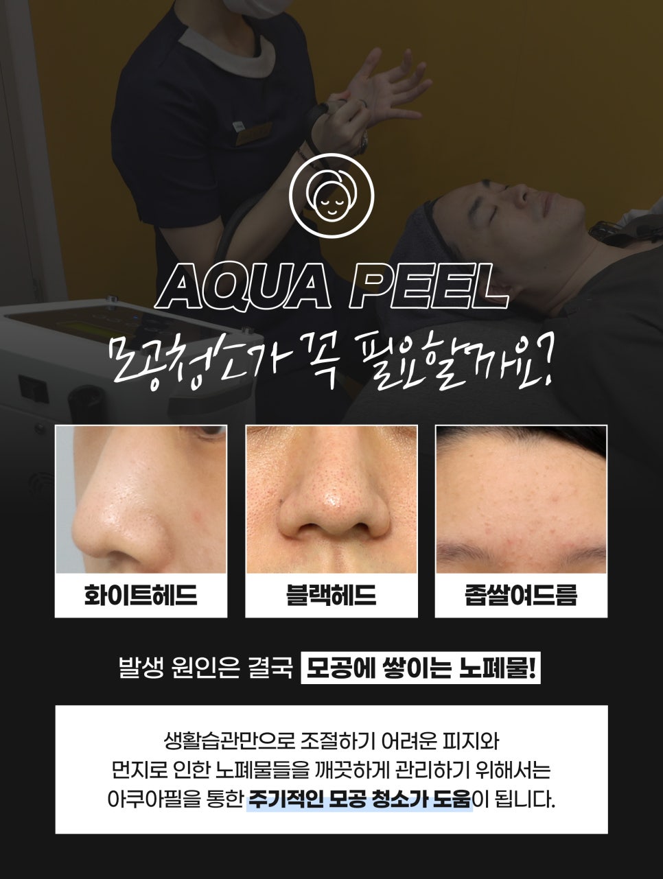 넓어진모공 고민, 깐달걀 나비존케어로 해결 관련 이미지 4