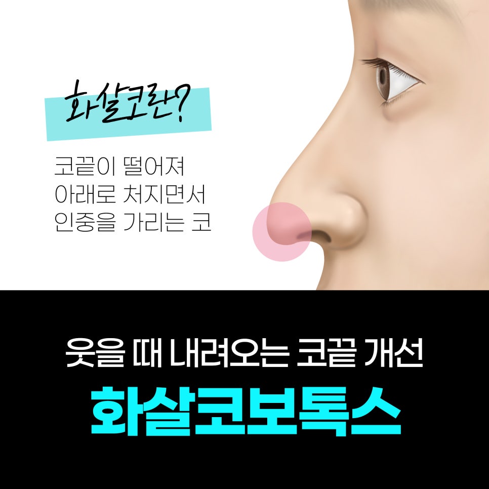 Naturally Improve a Drooping Nose Tip When You Smile with Arrow Nose Botox image 1