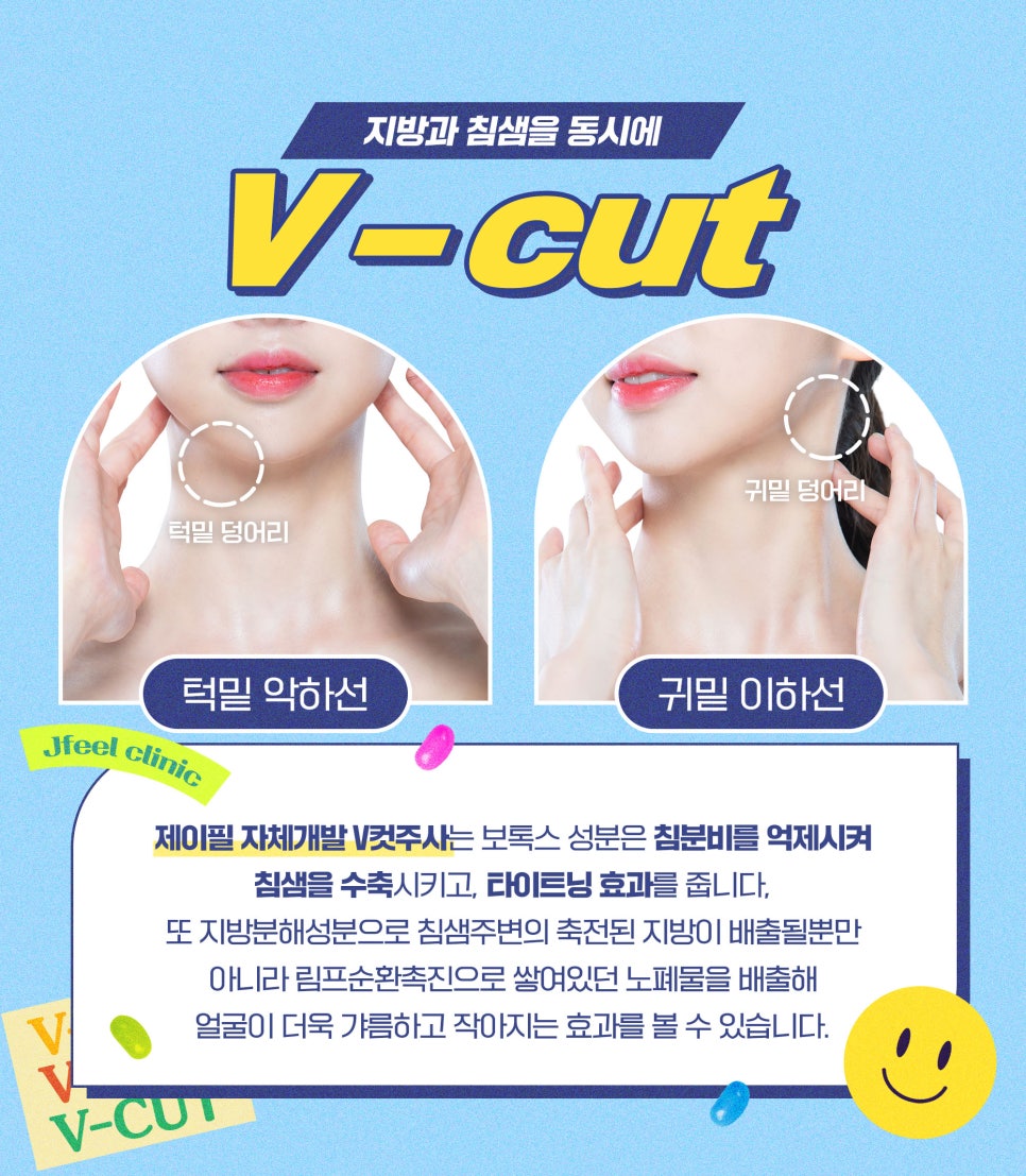 침샘보톡스와 윤곽주사의 만남 제이필 V컷주사 관련 이미지 4