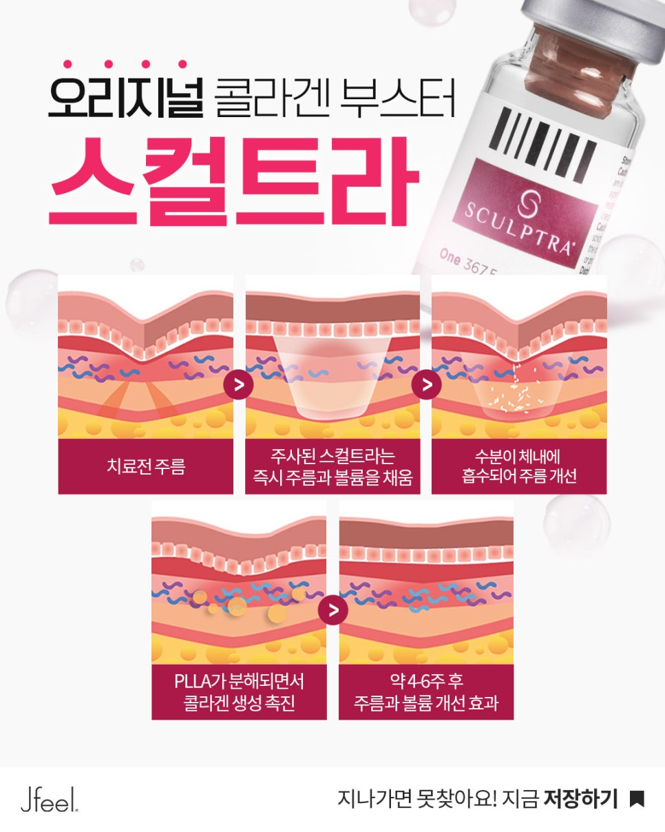 볼·관자·팔자 꺼짐, 얼굴살 빠진 게 아니라 콜라겐 감소일 수 있습니다|스컬트라 관련 이미지 5
