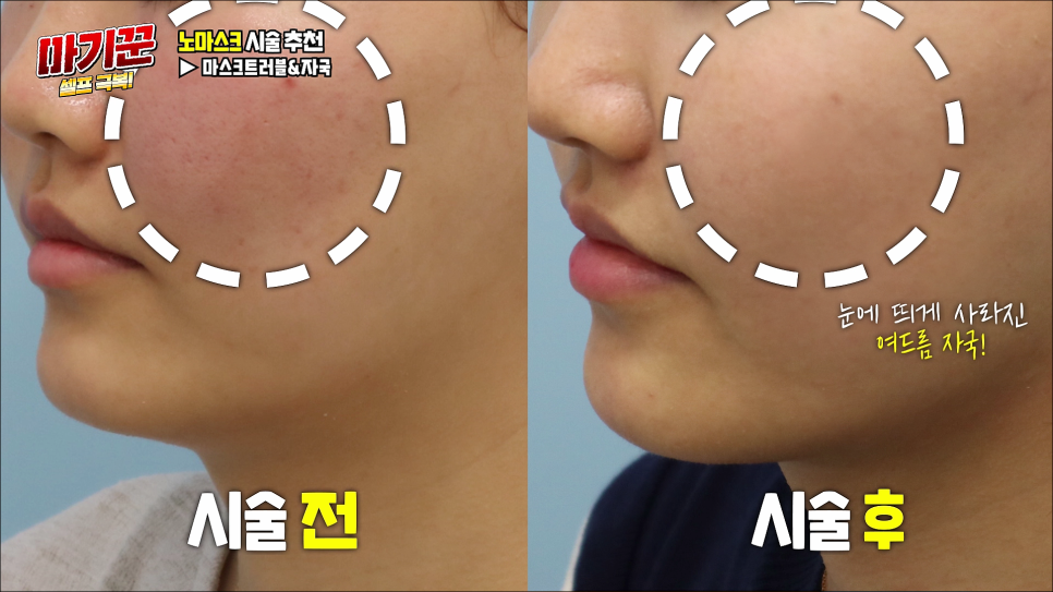 NO마스크 자신감을 올려봐요 마기꾼 셀프 극복! 관련 이미지 15
