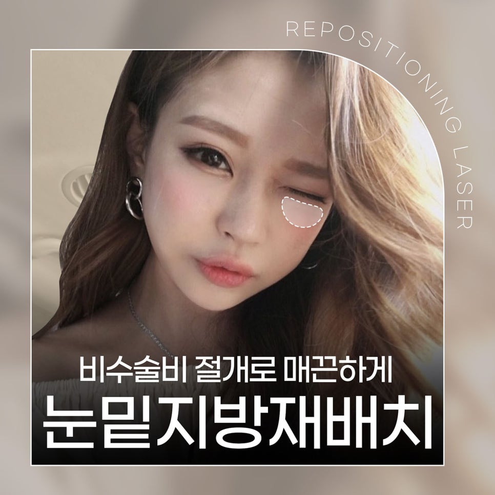 눈밑지방제거방법을 찾는다면? 비수술 비절개로! 관련 이미지 1