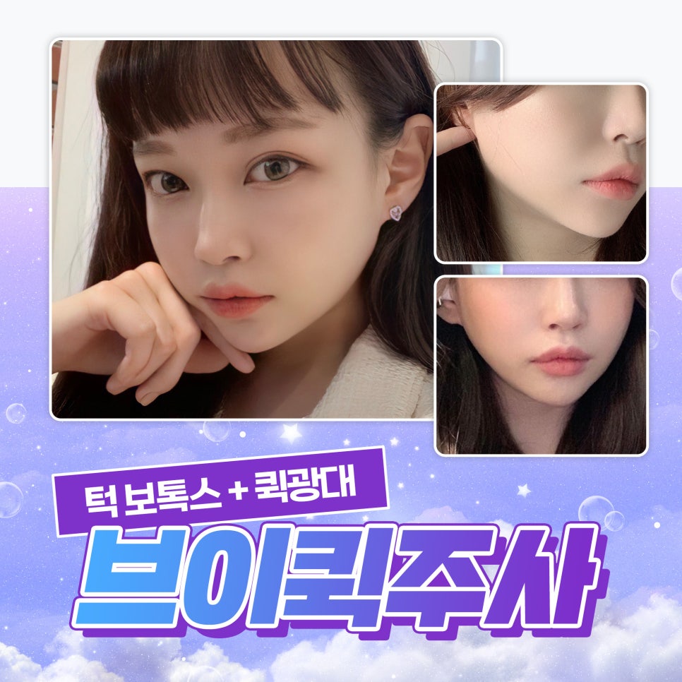 사각턱주사 얼굴 라인 개선을 원한다면 관련 이미지 1