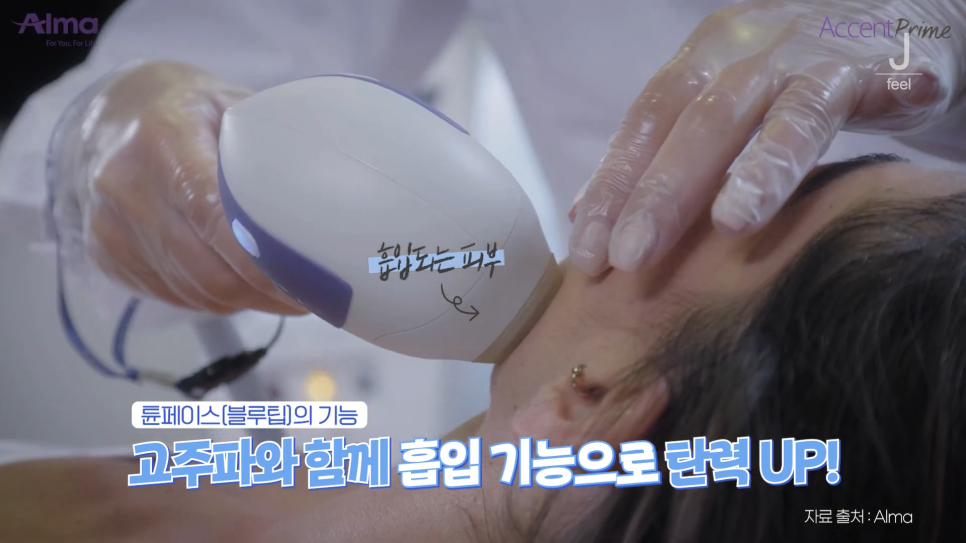 인모드와 튠페이스&튠라이너 차이점 관련 이미지 3