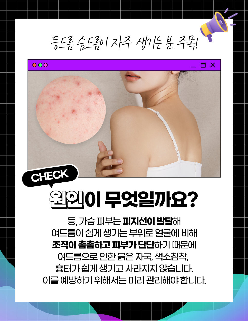등드름가드름, 여름 되기 전에 없애자 관련 이미지 2