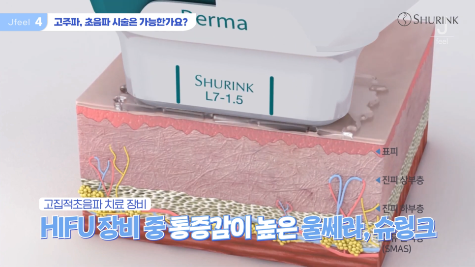 임산부피부과 시술 가능한가요? Q&A 관련 이미지 14