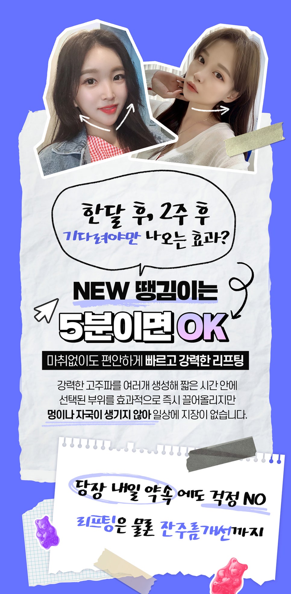 땡김이리프팅으로 타이트닝 확실하게 관련 이미지 4