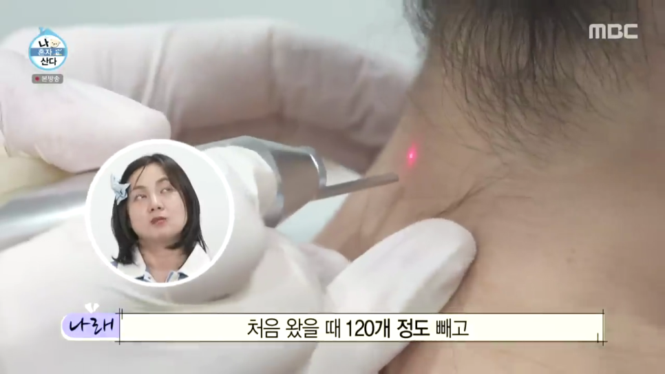 나혼산 박나래 쥐젖제거 홍대 쥐젖 피부과 얼굴 목 쥐젖 제거 비용 관련 이미지 3