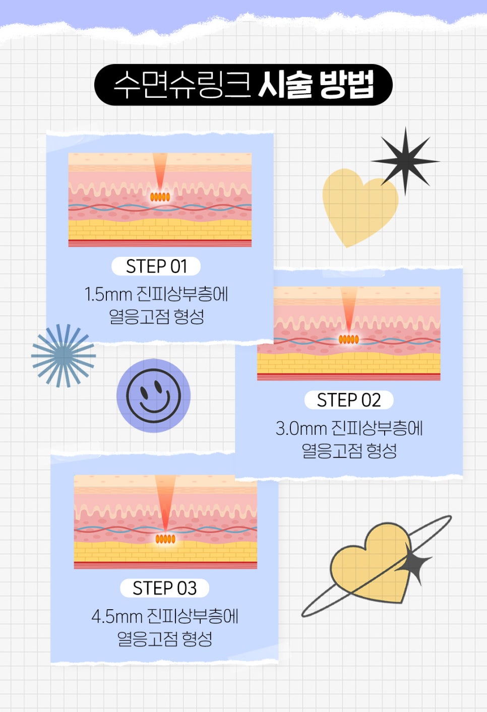 수면슈링크로 편안하게 탄력 UP 관련 이미지 5