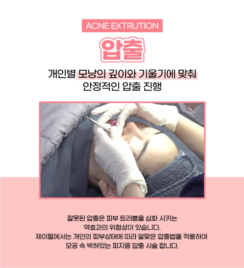 마드름 끝장내기? 제이필 마그네스 이벤트로! 관련 이미지 6