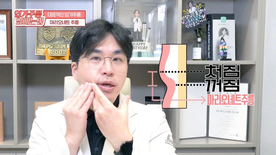 입가주름시술, 원인부터 치료, 예방까지 한 번에 관련 이미지 9