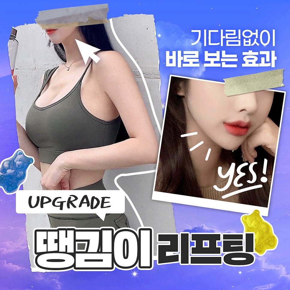 이중턱제거 땡김이, 인모드보다 빠르게 나타나는 효과 관련 이미지 1