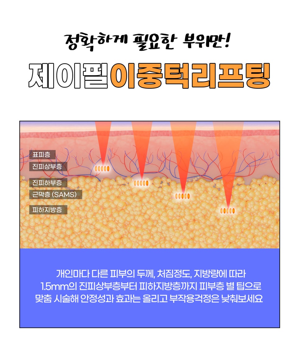 이중턱리프팅, 두 번 당겨서 더 탄탄하게 관련 이미지 4