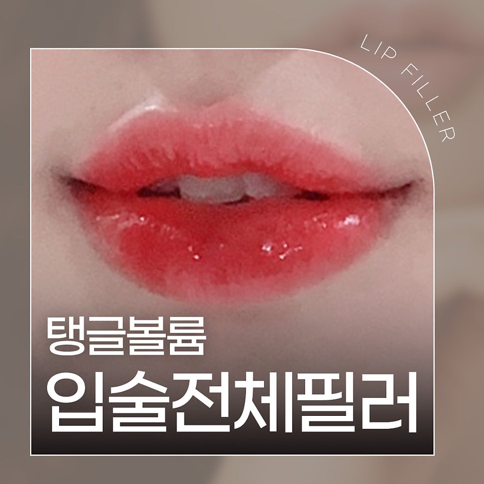 입술전체필러로 탱글 볼륨 만들기 관련 이미지 1