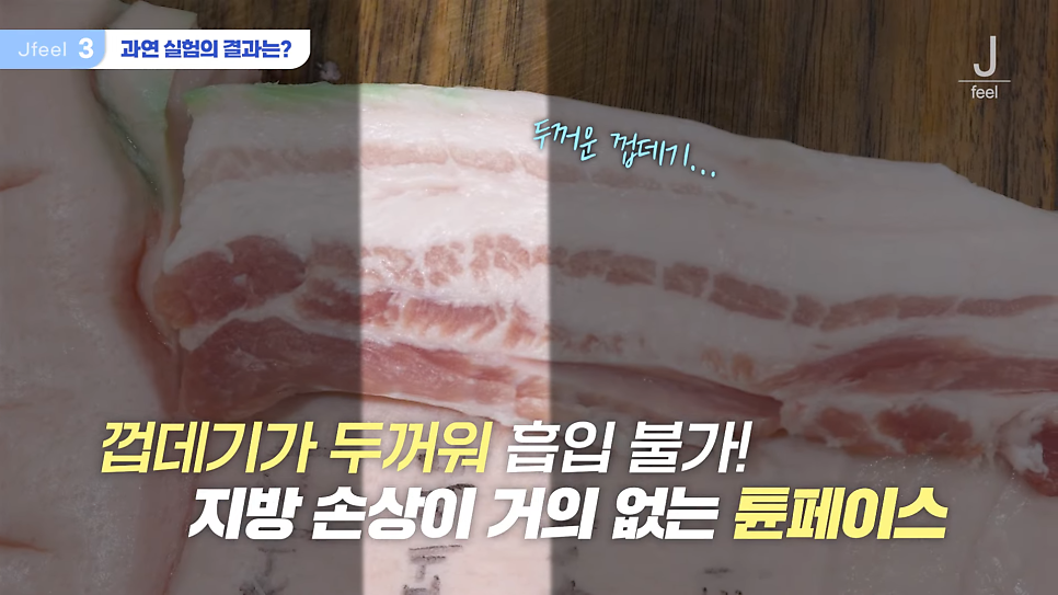 지방레이저가 얼굴 지방을 얼마나 녹일 수 있을까? 관련 이미지 8