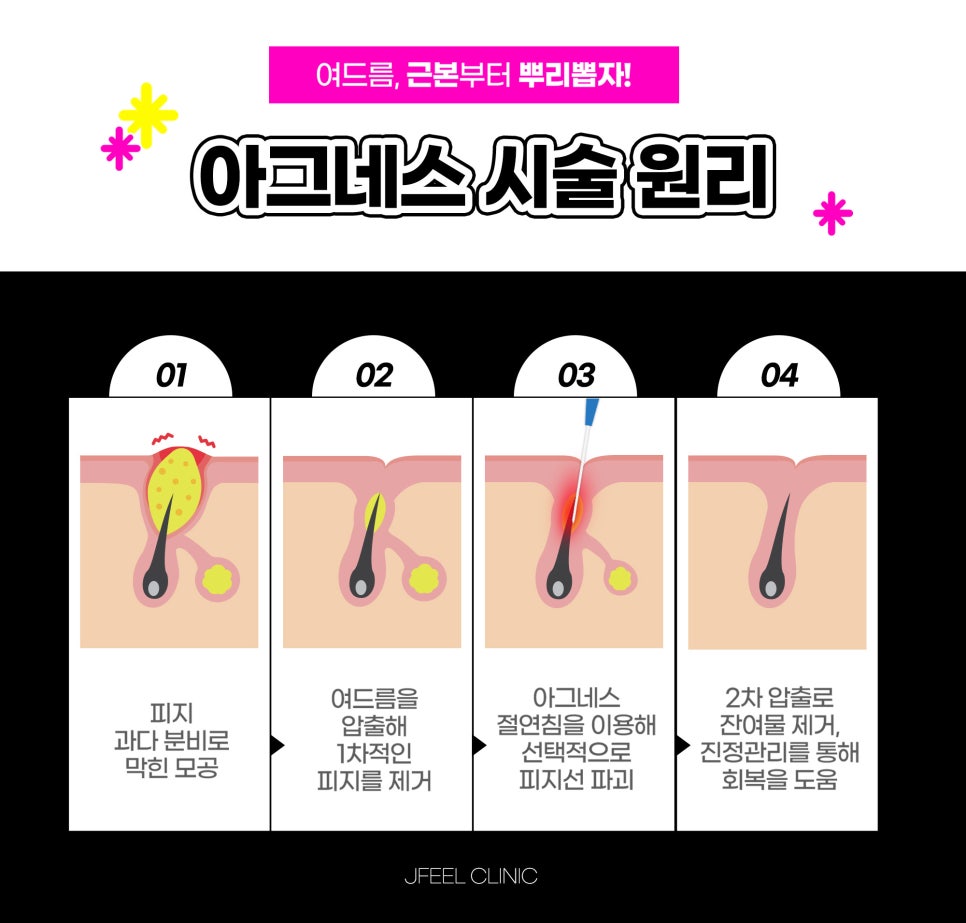 마스크피부염 더 이상 생기지 않도록 관련 이미지 5