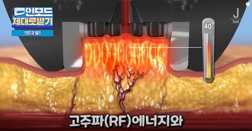 인모드효과 못 보셨다면 여기로 관련 이미지 3
