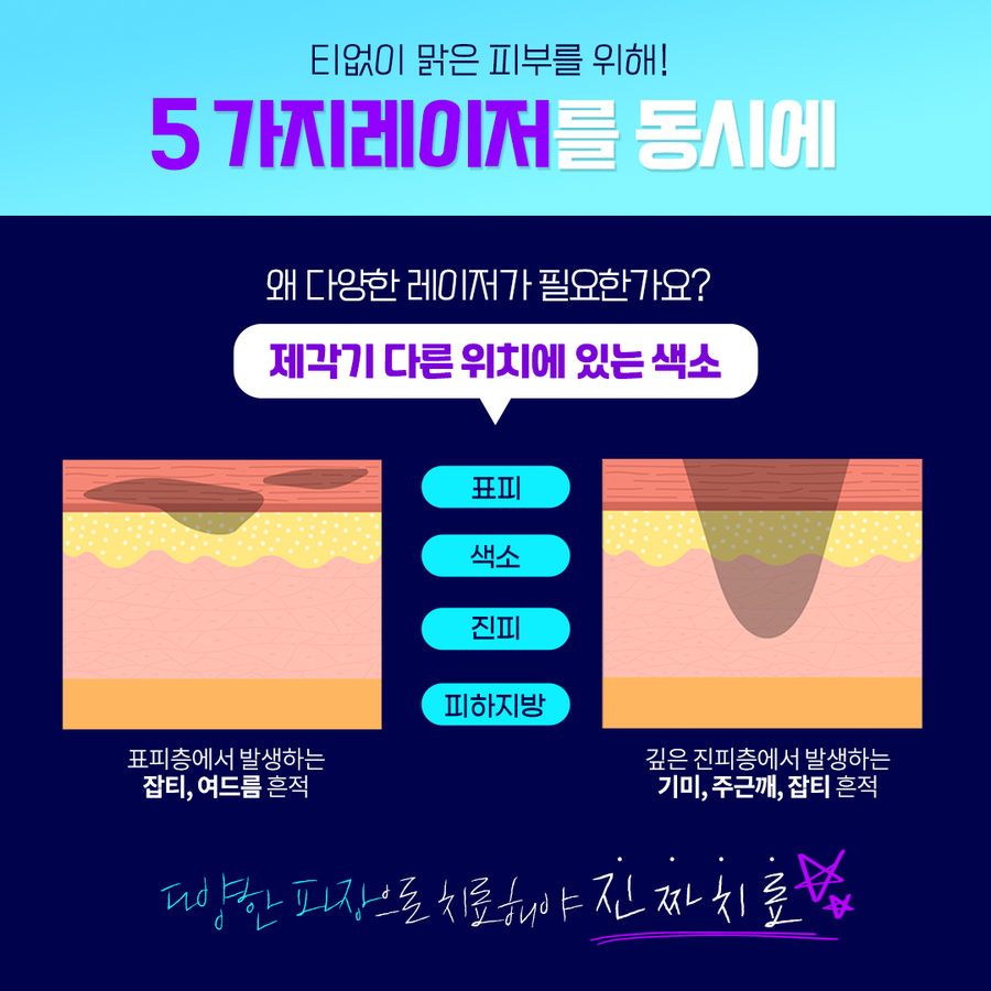 레이저시술로 모공,잡티,기미,피부톤개선이 가능할까요? 관련 이미지 11