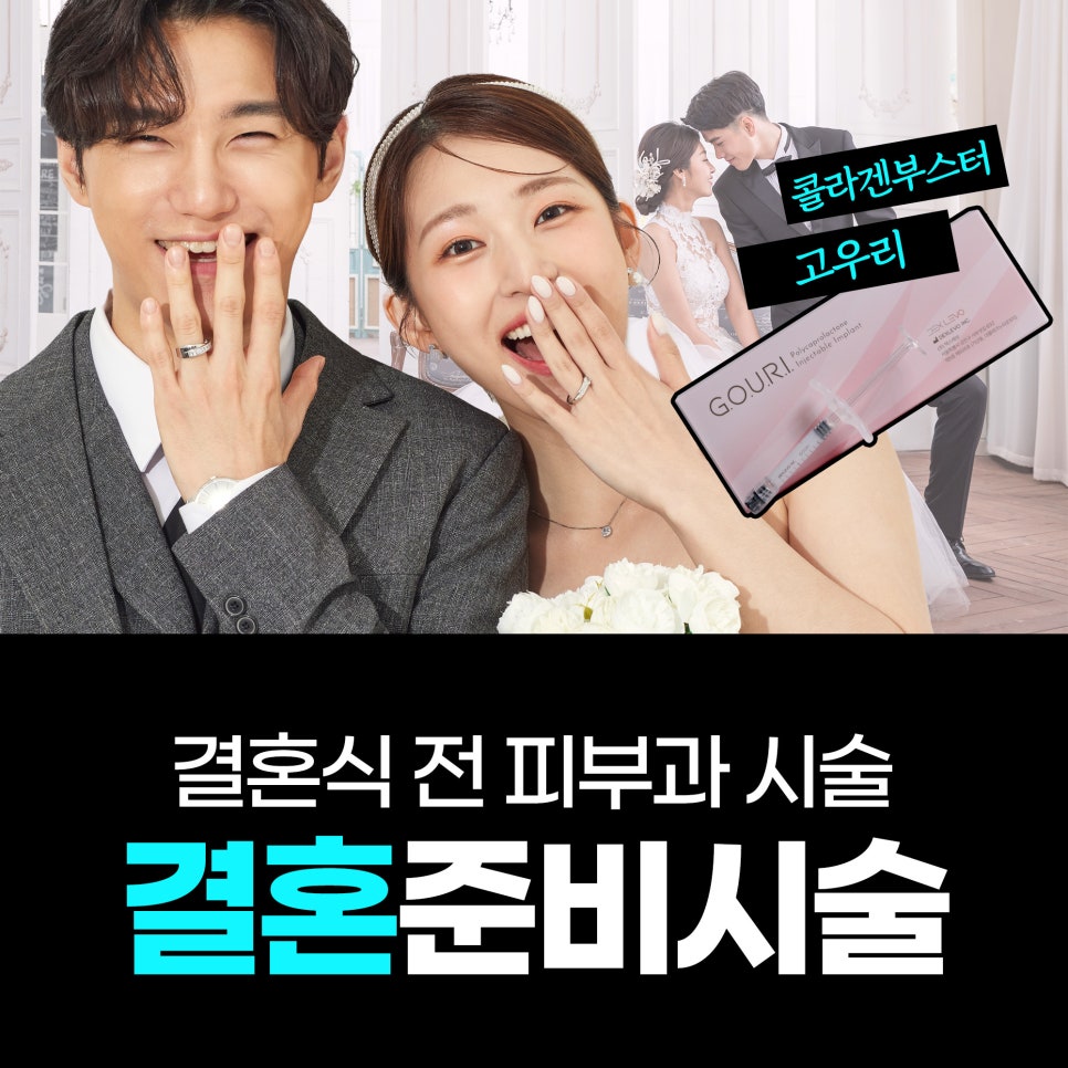 웨딩 피부관리 언제부터? 고우리&middot;울쎄라&middot;포텐자 결혼식 D-90 시술 총정리 관련 이미지 1