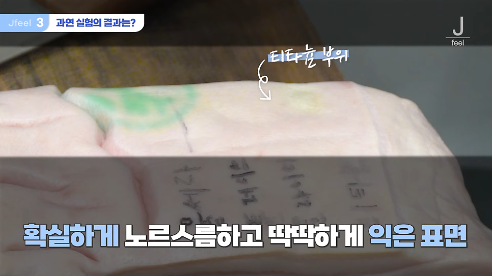 지방레이저가 얼굴 지방을 얼마나 녹일 수 있을까? 관련 이미지 13