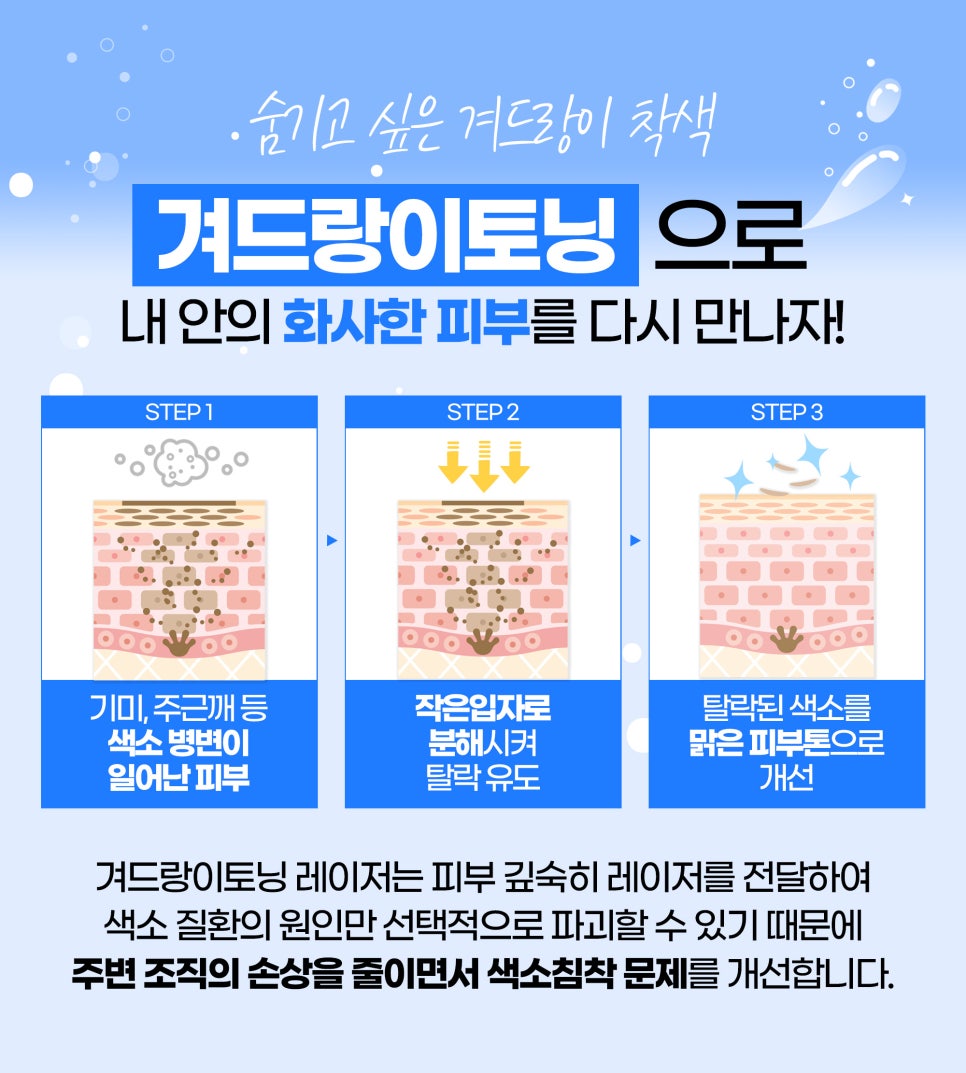 홍대제모 겨드랑이토닝은 제이필에서! 관련 이미지 4