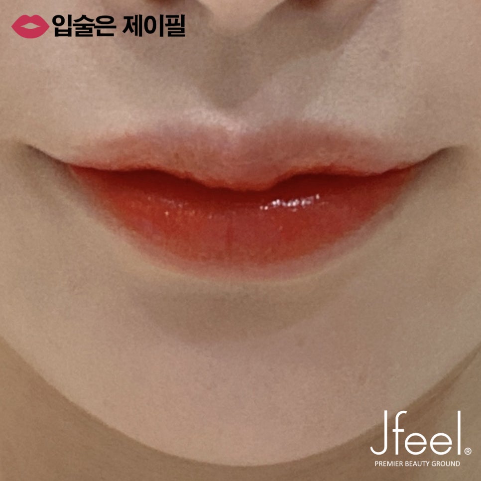 입술필러 유지기간 얼마나 되나요? 관련 이미지 7