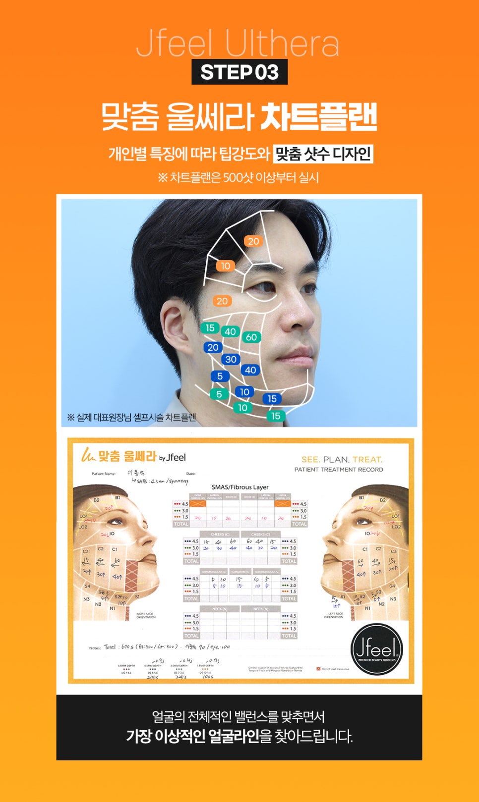 인스티튜터의 맞춤울쎄라로 리프팅효과 확실히보세요 관련 이미지 5