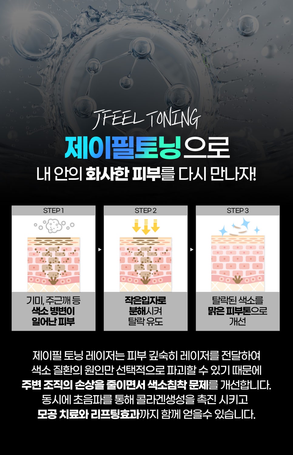 홍대토닝 기미, 잡티는 제이필토닝으로 개선 관련 이미지 3